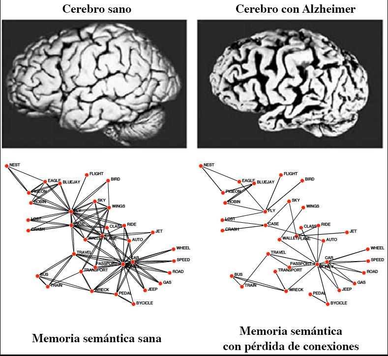 Alzheimer-BIFI_Yamir-Moreno